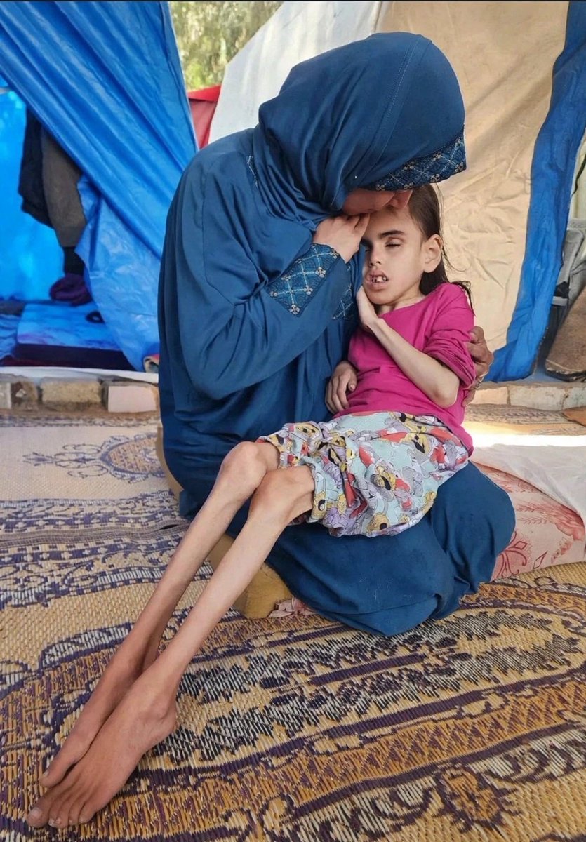 ros_sara2002's tweet photo. Her legs are just bones and skin

This is not famine, this is genocide by starvation https://t.co/8ZIbSp1NoI