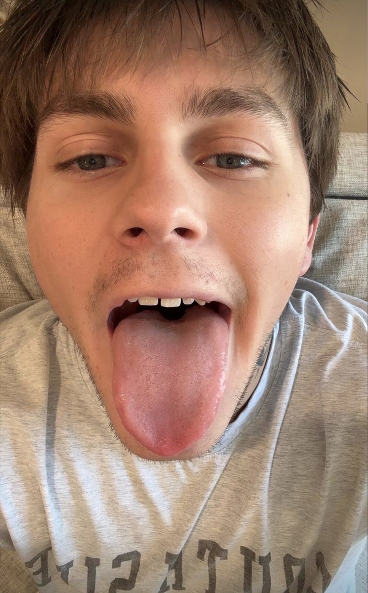 malemouth's tweet photo. Goon over his tongue https://t.co/eB1BQn3FFM