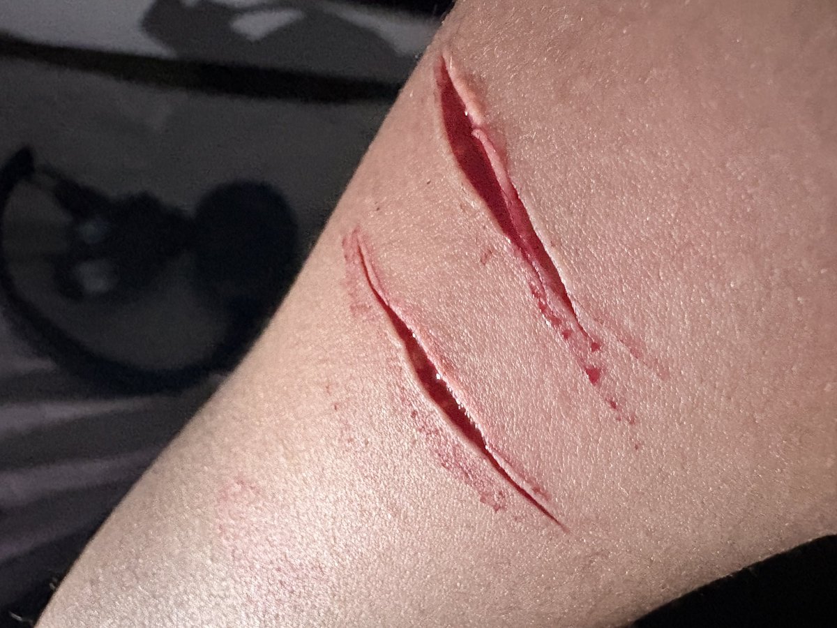 geeimj2's tweet photo. FAKE FAKE FAKE BLOOD 
HALLOWEEN MAKEUP https://t.co/pa71ReG8ct