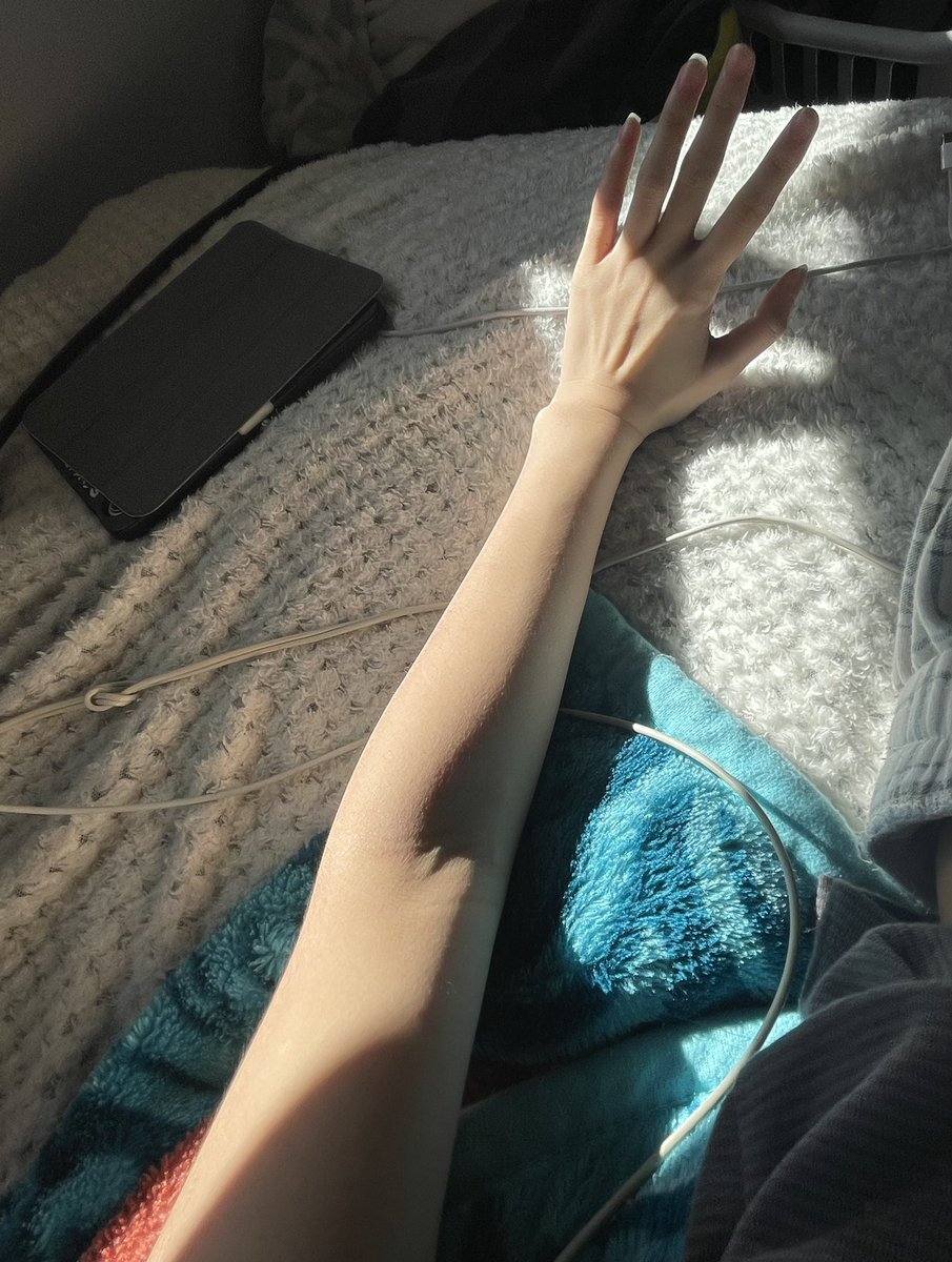 rrequ1em's tweet photo. sun on my arm 🌞 lowk havent opened this app very much https://t.co/dytFJfJkhj
