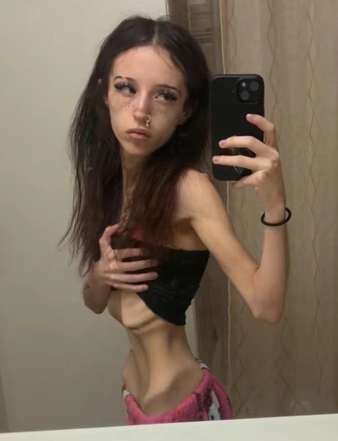 SkinnyAdmirer's tweet photo. #thinspo #thinspO0 #bonespo #bonesp0 #edtwt #anablur #edtw #twana #twed #edblur #edtblur #anatw #edrtwt #shedtwt https://t.co/m8oYbbpJOC
