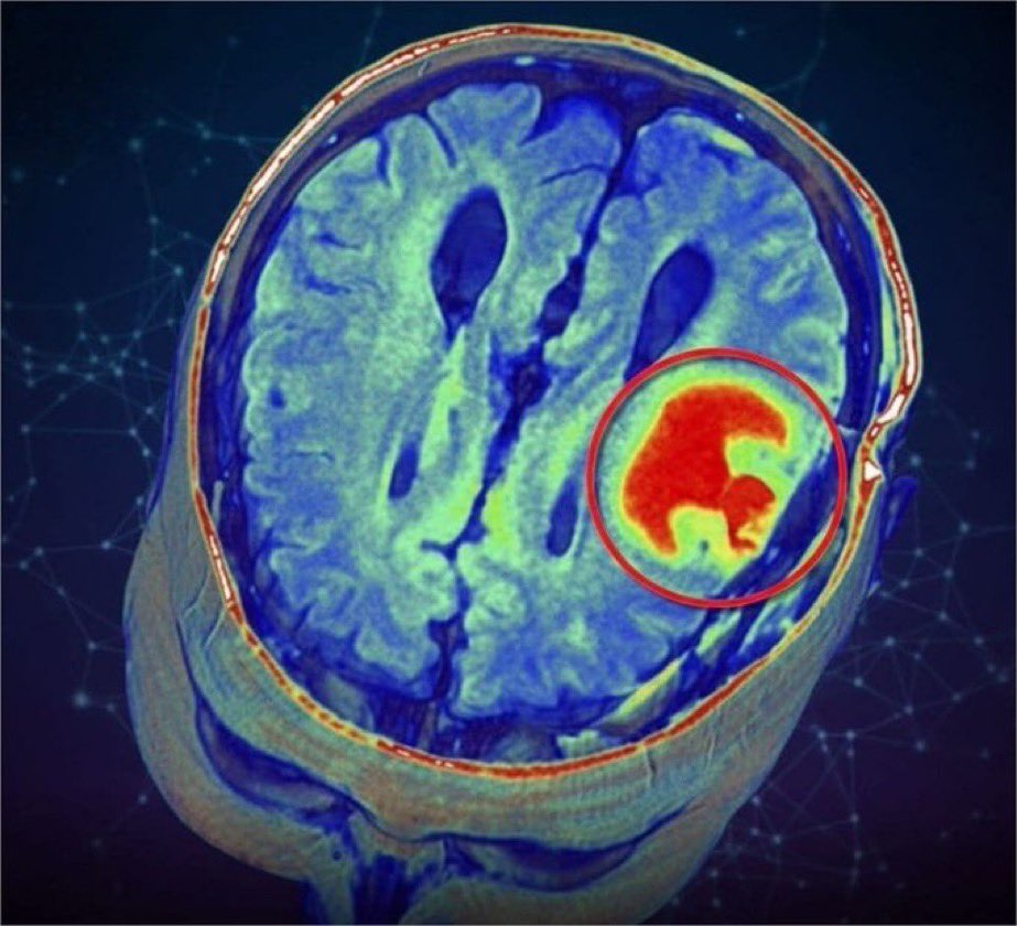 SciNatureNews's tweet photo. 🚨: Psychologists suggests we do not 'THINK' thoughts we 'RECIEVE' them https://t.co/tal8dpsnmB
