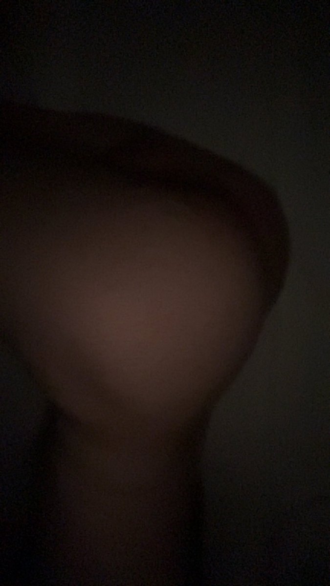 anaestheticcc0's tweet photo. ass felt so fat today :3
#femboy https://t.co/jwTPwgprBK