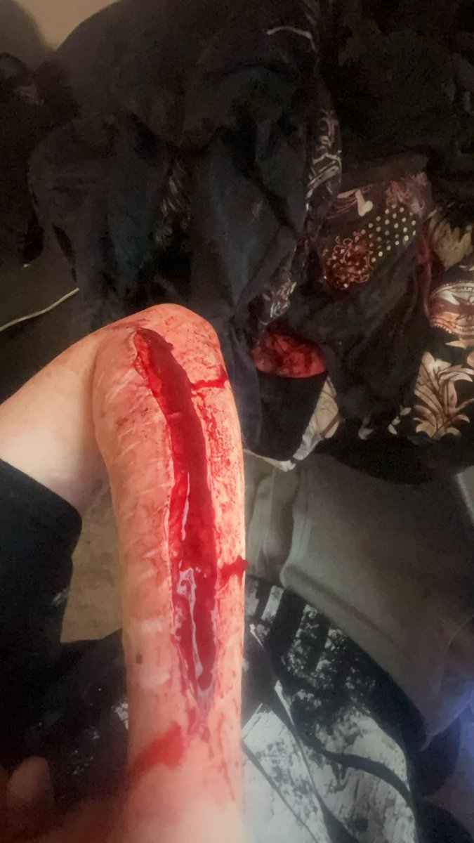 clashthetruthh's tweet photo. ⚠️SFX MAKEUP⚠️ #beanstwt https://t.co/0QRkdDehq9