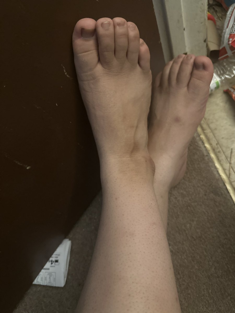 Slowbunny15's tweet photo. #feetfetısh #gayfeet https://t.co/id7R8cR6m5