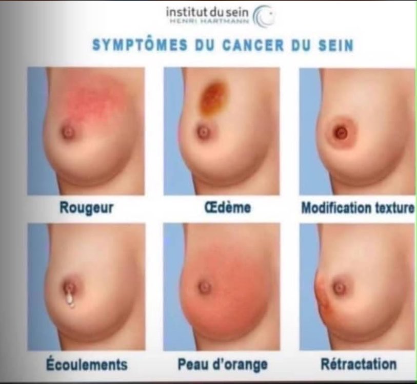 Fama__Dia's tweet photo. Vous pouvez partager autour de vous !! https://t.co/5LmLIKjIut