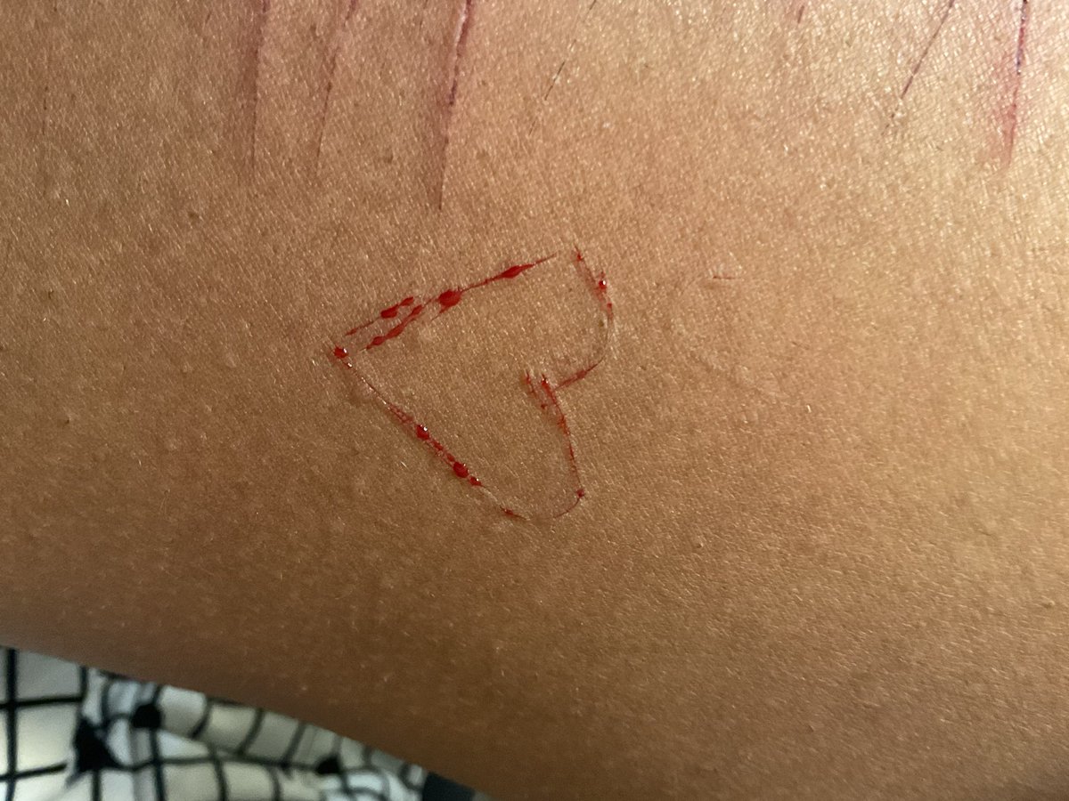 D34D_C0RPS's tweet photo. Heart!

I’ve been getting better at my Halloween makeup

Fake! SFX makeup!!! Fake blood!
#shrtwt #sh inspo: @Nichi34308206 https://t.co/jam9SVesTR