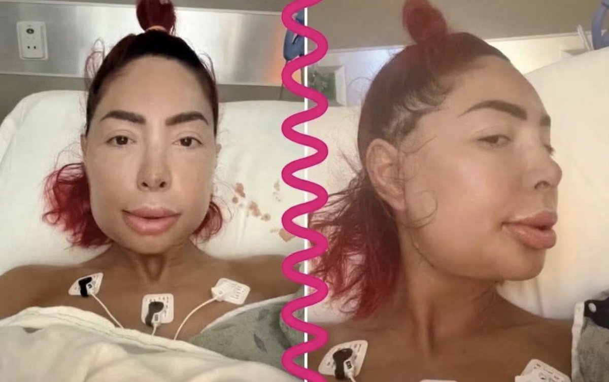 via @Auerlizci6 Farrah Abraham firsthand surgery photos