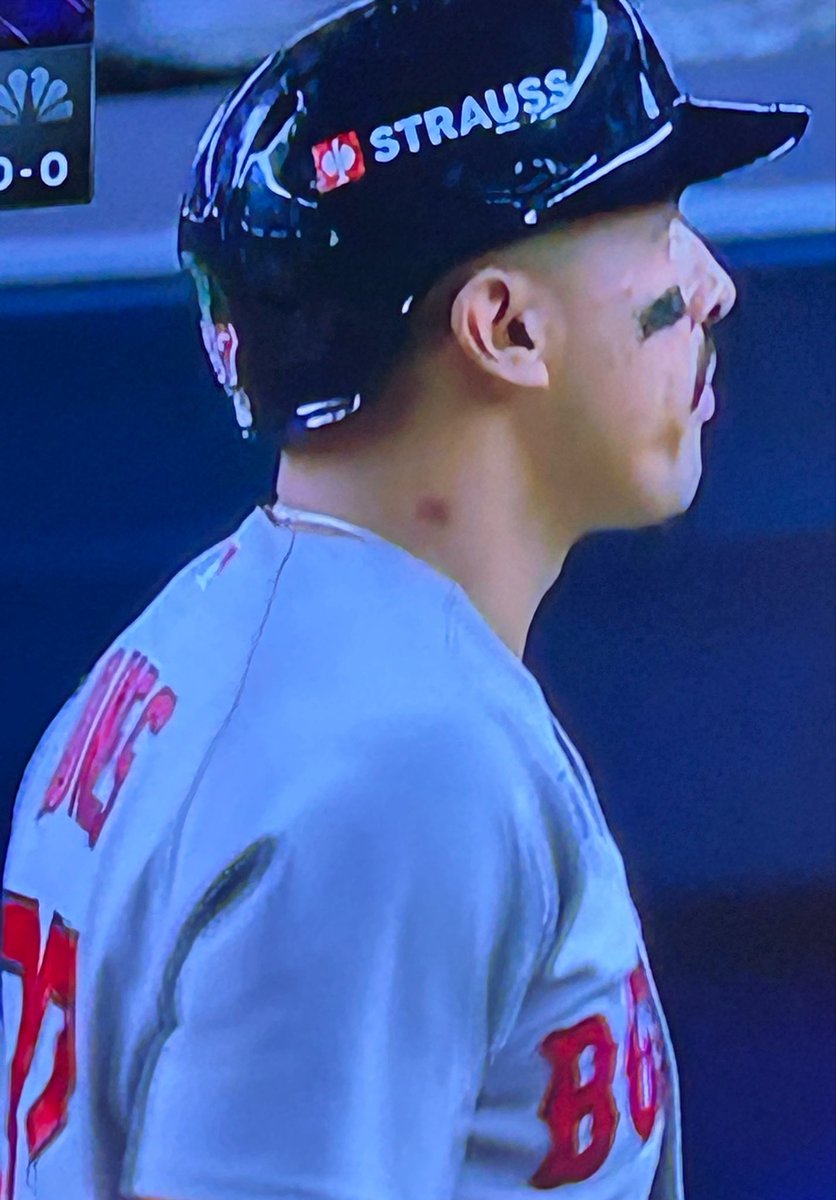 fraserdatsyuk's tweet photo. Is that a hickey? Wait a minute…that means he had to… Jamai Jones you dog😂🤝 https://t.co/ADA642YBT6