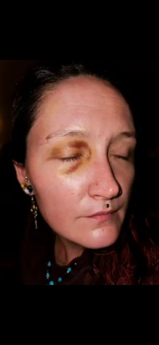 Pinkii_lockedin's tweet photo. @FluffyBunny_007 Nothing to be proud of, youre protecting a well known repeated woman abuser.. you fell into his smear campaigning when all actual evidence points to him being the real offender. Thank you please keep your community safe 🙏🏽 https://t.co/Q6LCsHV5ck