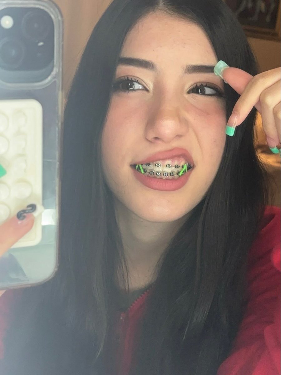 bracefaceSoph's tweet photo. Retweet to Interact

(warning: I'm ugly) https://t.co/BcEDdnTCxI