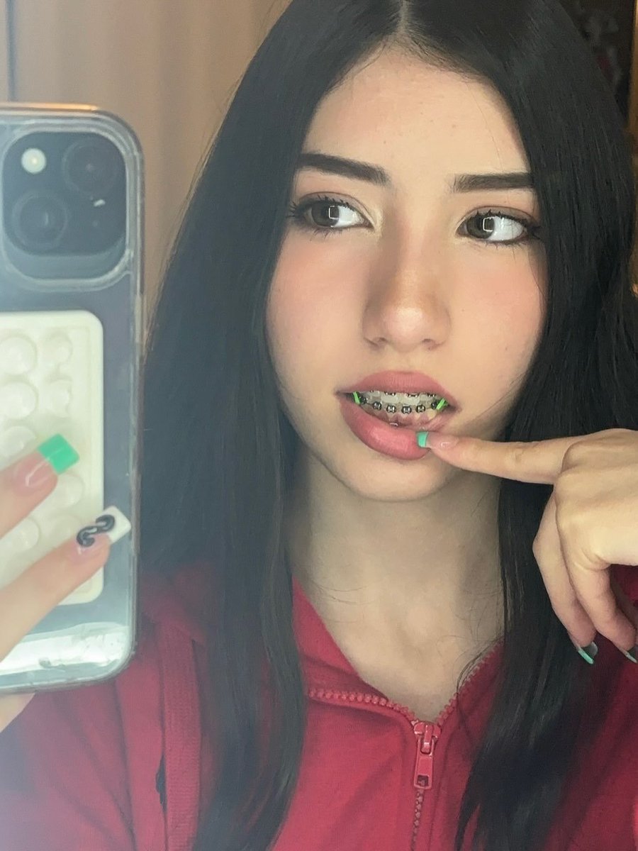 bracefaceSoph's tweet photo. Retweet to Interact

(warning: I'm ugly) https://t.co/BcEDdnTCxI