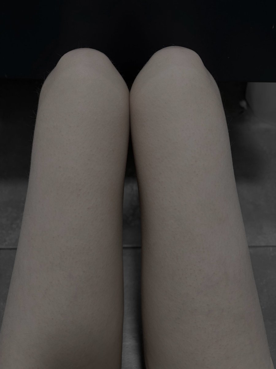 Denxoxoxo's tweet photo. Thigh gap but 8 month looking belly https://t.co/nL3JiTeHfg