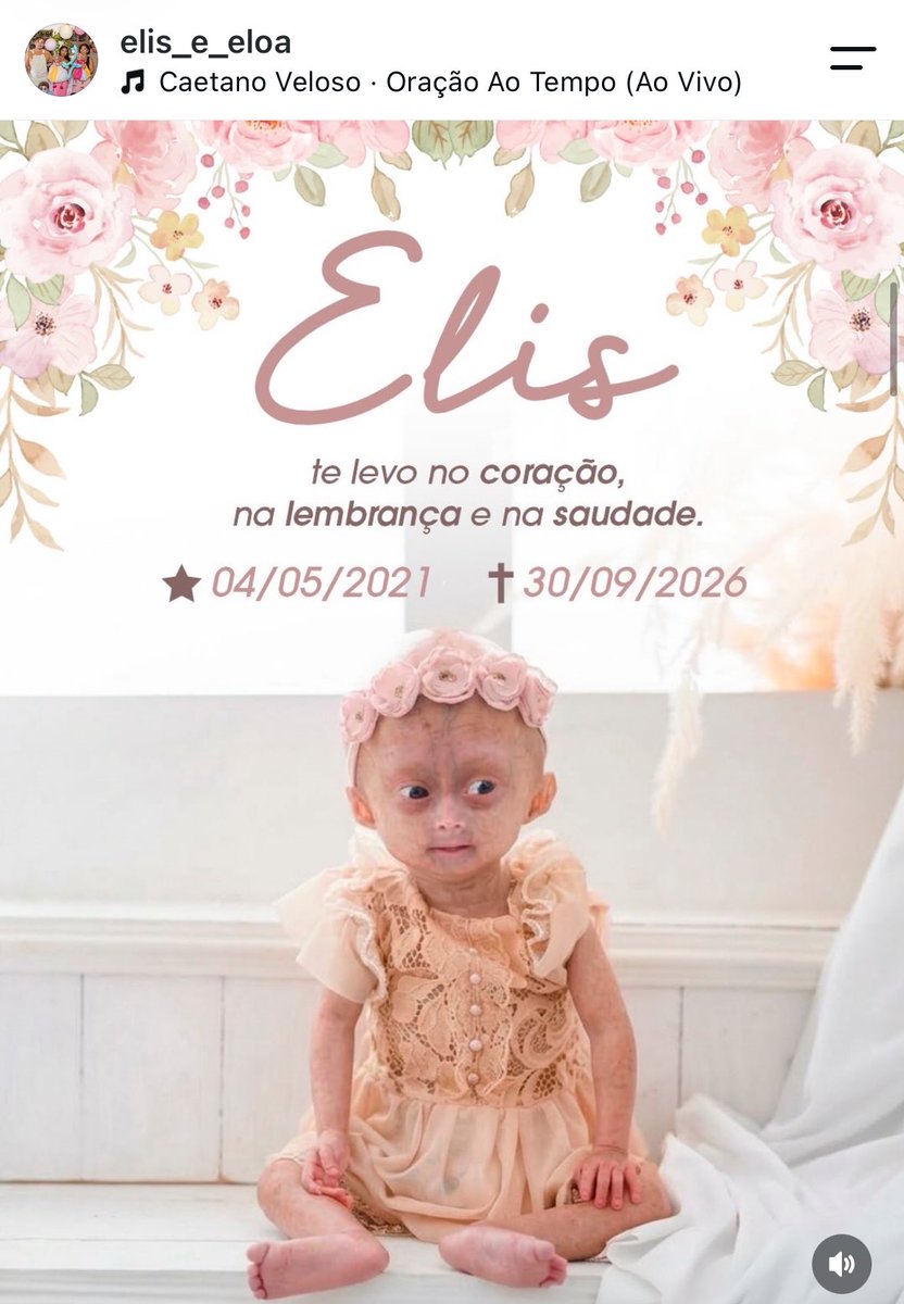 Iunadied's tweet photo. eu sigo esse perfil que mostra a vida de duas gêmeas com uma doença rara que causa envelhecimento acelerado, acompanho desde que eram beeem pequeninhas

hoje uma das gêmeas se foi, apenas 5 aninhos :( https://t.co/m6H3BfOFUy