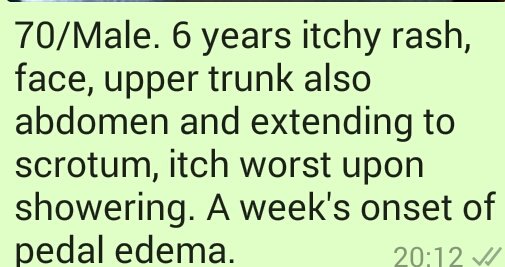 JosephOgavu's tweet photo. Back in Sept 2016, when I had no regard for Social media, someone shared this with me.

If I had known better, the team here would have solved the problem in no time!

1. What is the diagnosis!
2. What are the DDx!
3. How would you manage!

@oriba_dan
@internist
#RENAHIBISCUS
##MedTwitter