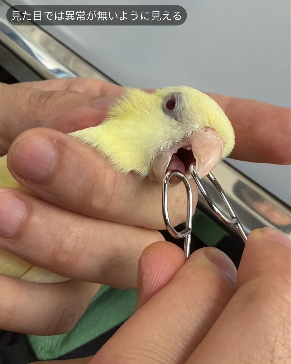 masanomoriAH's tweet photo. 今回はセカンドオピニオンでご来院いただいた、1歳・体重44gのサザナミインコさんのカンジダ症についてのお話です。

サザナミインコさんは、以前から通っていた病院で治療を受けていたものの症状が改善せず、ペレットが食べられない、よだれが多いといった症状が続いており、体重も60gあったところから44gまで痩せてしまっているということでご来院されました。

口腔内検査と便検査を行ったところ、カビの一種であるカンジダが検出され、カンジダ症と診断しました。カンジダ症は、消化管に常在するカンジダというカビが何らかのきっかけで異常増殖してしまうことで発症する病気で、口腔内や食道、そ嚢(そのう)などに炎症を引き起こします。今回のようによだれの増加やペレットが食べられない、体重減少といった症状が長引いている場合、消化管全体にカンジダが広がっている可能性があり、改善が見られないまま放置すると、栄養状態がさらに悪化し命に関わることもある病気です。今回は適切な抗真菌治療を行った結果、治療開始から10日で体重は54gまで回復し、よだれもなくなり、ペレットももりもり食べられるほど元気な姿を取り戻すことができま��た。

カンジダ症の子は、口の中や食道に炎症が起こることでよだれが増えたり、ペレットや餌をうまく飲み込めなくなったりします。食欲があってもうまく食べられずに体重が減少してしまうことも多く、今回のように一見「食欲がなくなった」ように見えるケースでも、実際にはうまく食べられていないだけということも少なくありません。そ嚢の動きが悪くなったり、吐き戻しが見られたりすることもあります。

カンジダは本来、健康な体の中にもわずかに存在している常在菌ですが、免疫力の低下やストレス、不衛生な飼育環境、抗生剤の長期使用による腸内フローラの乱れなどをきっかけに異常増殖し、症状を引き起こします。栄養バランスの偏りや、他の病気に伴う体力低下が背景にあることも少なくありません。

予防のためには、ケージや食器を清潔に保ち、免疫力を落とさないようバランスの良い食事と適切な温度・湿度管理を心がけることが大切です。また、��生剤を使用する際は自己判断で長期・過剰に使用しないことも重要です。今回のように、他院での治療で改善が見られない場合には、原因を再検討するためにも早めのセカンドオピニオンの検討をおすすめします。

まさの森・動物病院では、サザナミインコをはじめとする鳥類やその他どんな動物種でも積極的に診療しており、セカンドオピニオンも承っております。ペレットが食べられない、よだれが多い、体重が減ってきているなど、いつもと違う様子が見られましたら、早めにご連絡ください。