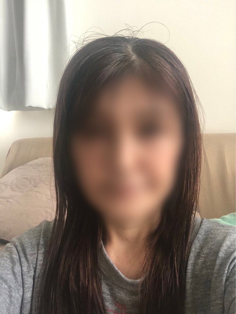 remionany's tweet photo. 最近シワも増えたし、顔も気に入らないし整形したい…😢
と言いながらすっぴんを投稿する私は矛盾だらけ！
リツイートして良いコメントくれた人には抽選で3名にぼかし無しの顔写真あげるよ。 https://t.co/QAyHWcfTn8