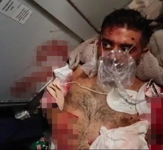 MargoEpperson1's tweet photo. @MostlyKohli This hero was lucky a doctor came forward to save him. https://t.co/iOpzWv0Kxg