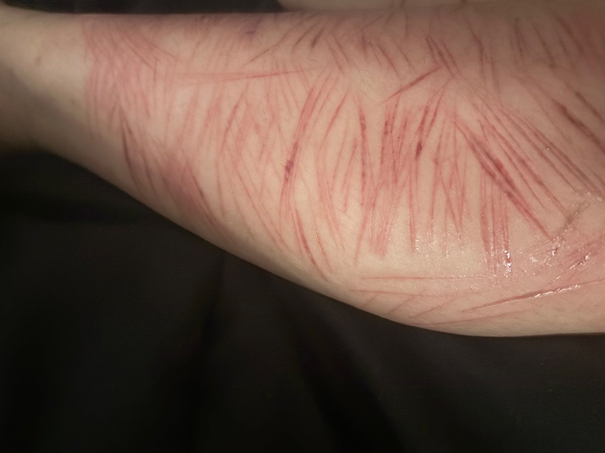 Sharktophus's tweet photo. Did these like a month ago but idgaf 

Tags: shedtwt, sh, cuts, slashflash, 🏚️twt, cutspo https://t.co/OqpsaqPsPq