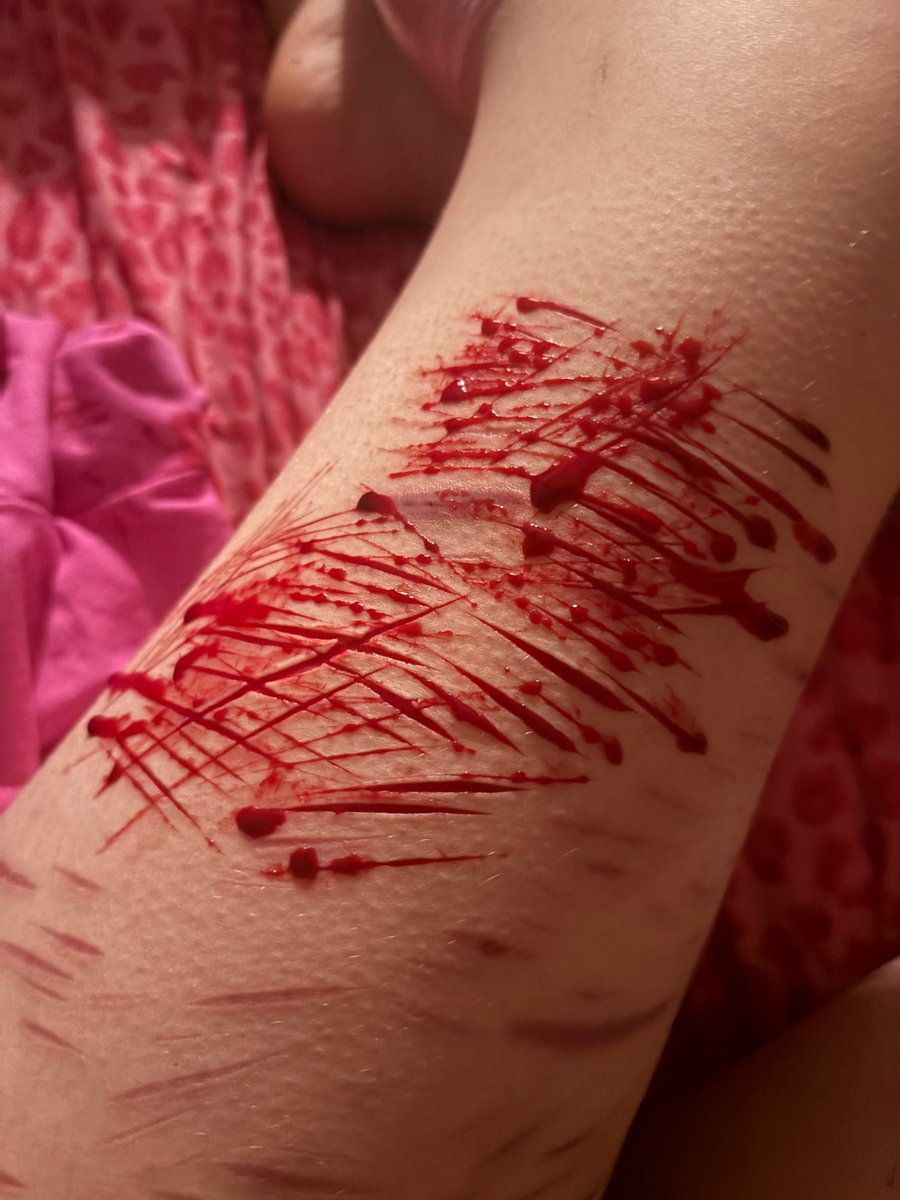 Sharktophus's tweet photo. Did these like a month ago but idgaf 

Tags: shedtwt, sh, cuts, slashflash, 🏚️twt, cutspo https://t.co/OqpsaqPsPq