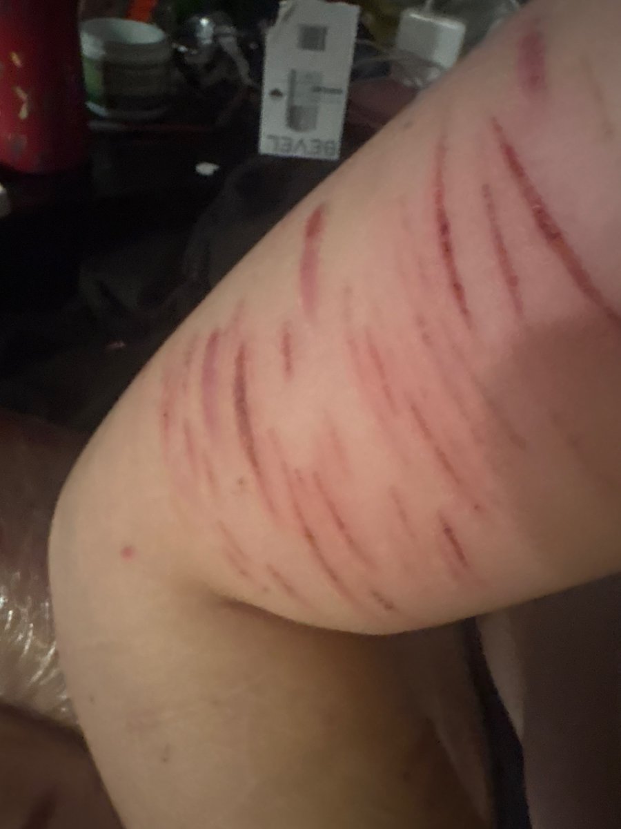 Sharktophus's tweet photo. Did these like a month ago but idgaf 

Tags: shedtwt, sh, cuts, slashflash, 🏚️twt, cutspo https://t.co/OqpsaqPsPq
