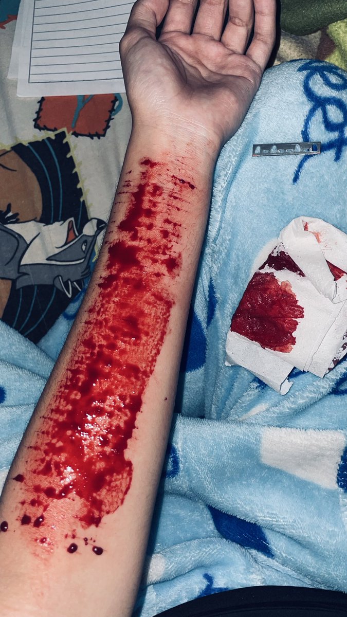 chanchanpilin's tweet photo. uno viejo #shtwt #selfharm #py https://t.co/TFigzKBuIo