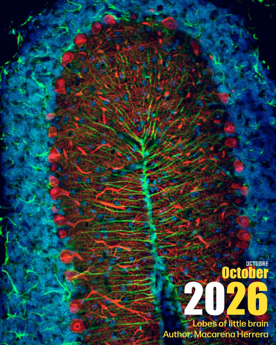 NeuroAlc's tweet photo. 🍂 ¡Bienvenido, octubre! 🧠
Comenzamos el mes con la foto "Lobes of the little brain", una imagen #SciencePhoto_IN de Macarena Herrera @LabEHerrera 
📸 La ciencia, vista a través de otra mirada. https://t.co/bmRzuRGVG2