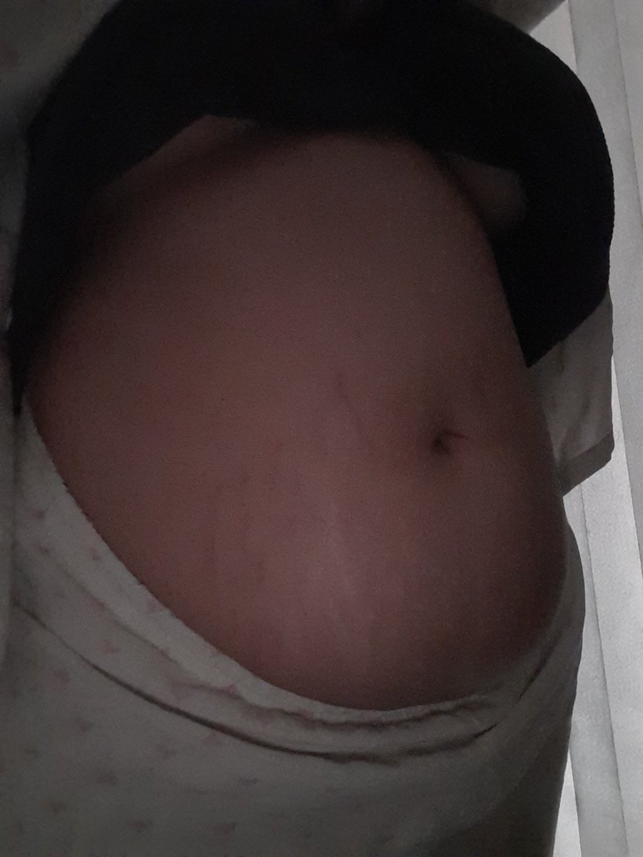 PhaunChu's tweet photo. Holaa como han estado? Hoy es fin de mes así que quise ver como me ha ido... hoy peso 76.25 kg. Me siento algo frustrada pq creí que pesaria más :c

#fatgirlbelly #chubbygirl #ssbbwweightgain  #weightgaining #bigbelly #feederism #fatty #biggirl https://t.co/WtcRaEErs5