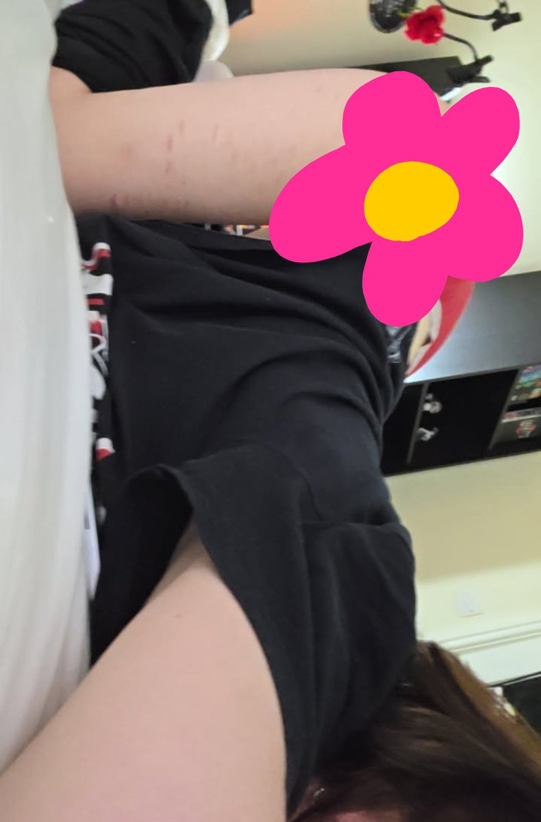 freakqore's tweet photo. I thought the flower would be a cute tease idea but clearly not heheh

#cosplay #val #egirl #sfxmakeup #feetworshi̇p #piercings #moots #of #altgirl #meow #nsfwtwt https://t.co/7zk3o8Se7f