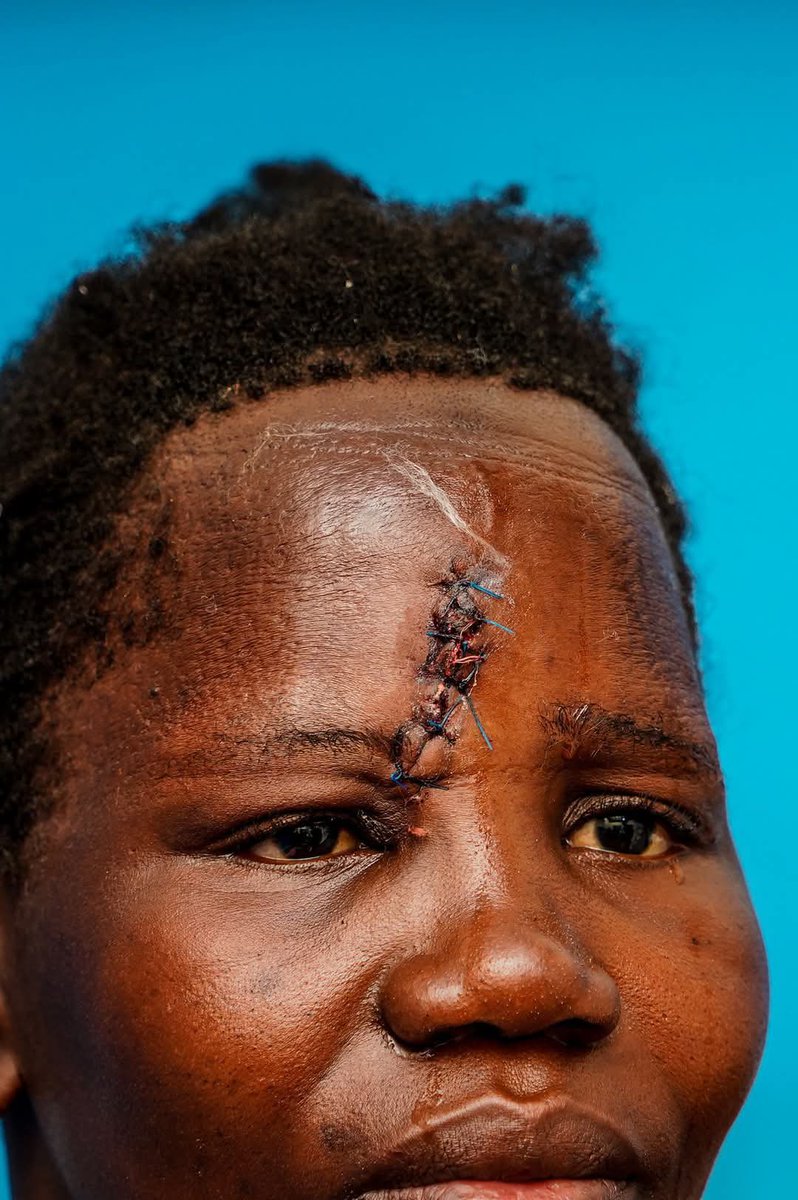NalukwagoJudith's tweet photo. “Some people are collecting signatures, where’s your people are being killed, they are being “detoothed”finger nails are being removed. Fellow Ugandans, Wake up!”
    
         Lt. Mabonga 2026 https://t.co/lO1KGRRVD2