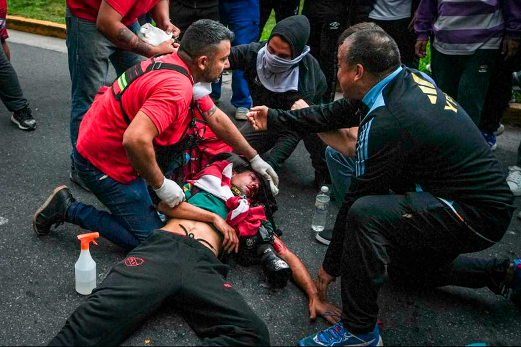 Red__Accion's tweet photo. Un héroe colectivo

🫀 El 12 de marzo de 2025 Nicolás Chiarini, ex bombero voluntario, sostuvo de manera ininterrumpida el cráneo perforado del fotorreportero Pablo Grillo para que no se desangre. 

👮🏾‍♂️ Del otro lado, Héctor Jesús Guerrero, Cabo 1° de la Gendarmería Nacional, había disparado su escopeta lanzagases en ángulo horizontal -violando protocolos y manuales de uso- con el beneplácito de toda la cadena de mando, incluida Patricia Bullrich, por entonces Ministra de Seguridad.

💬 Esta es la crónica de cómo se perpetúa la violencia institucional para llegar a una situación semejante. Pero, sobre todo, es la crónica, en la voz de Chiarini, de lo que pasó la tarde en que sostuvo la línea de vida del fotorreportero en la palma de su mano. 

✍🏾 Por Andrés Manrique (ANRed).

📲 Leela acá: https://t.co/qeRx1eOedW