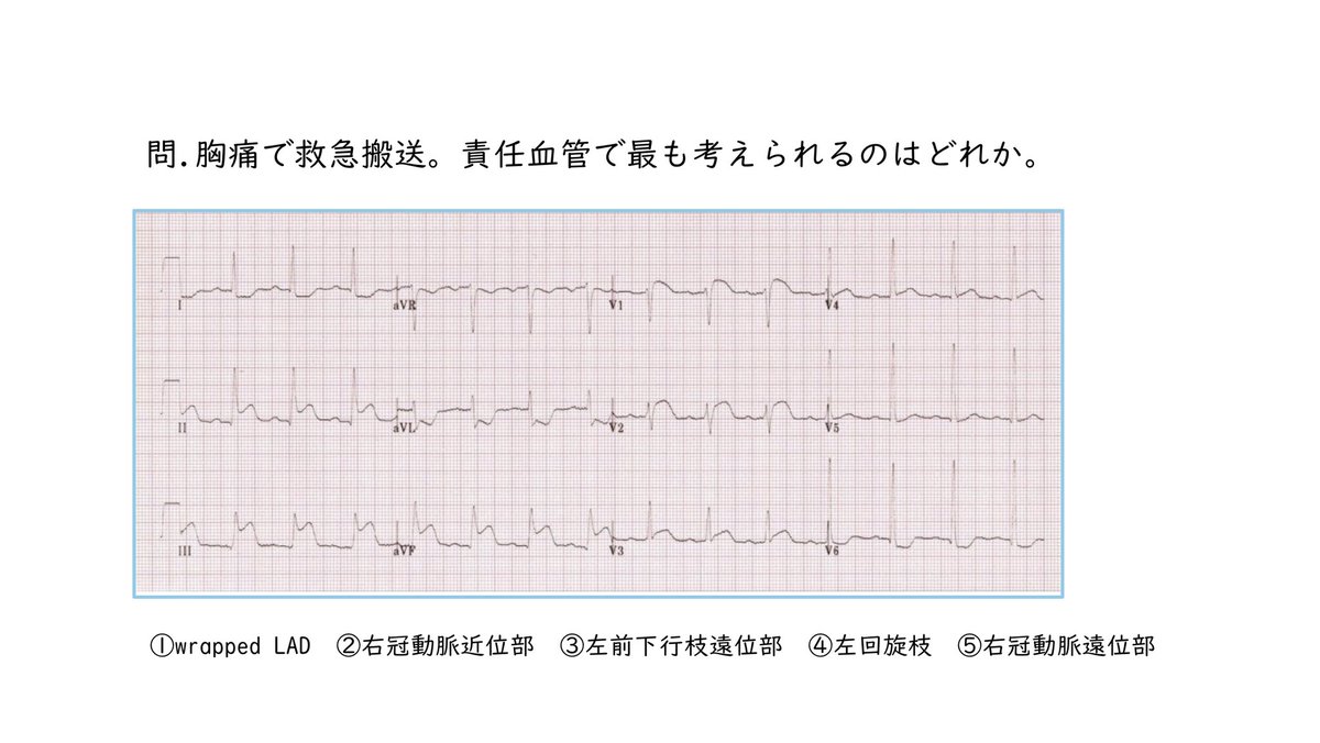 ka_mumuu's tweet photo. おまけ https://t.co/a0mVUQ763S