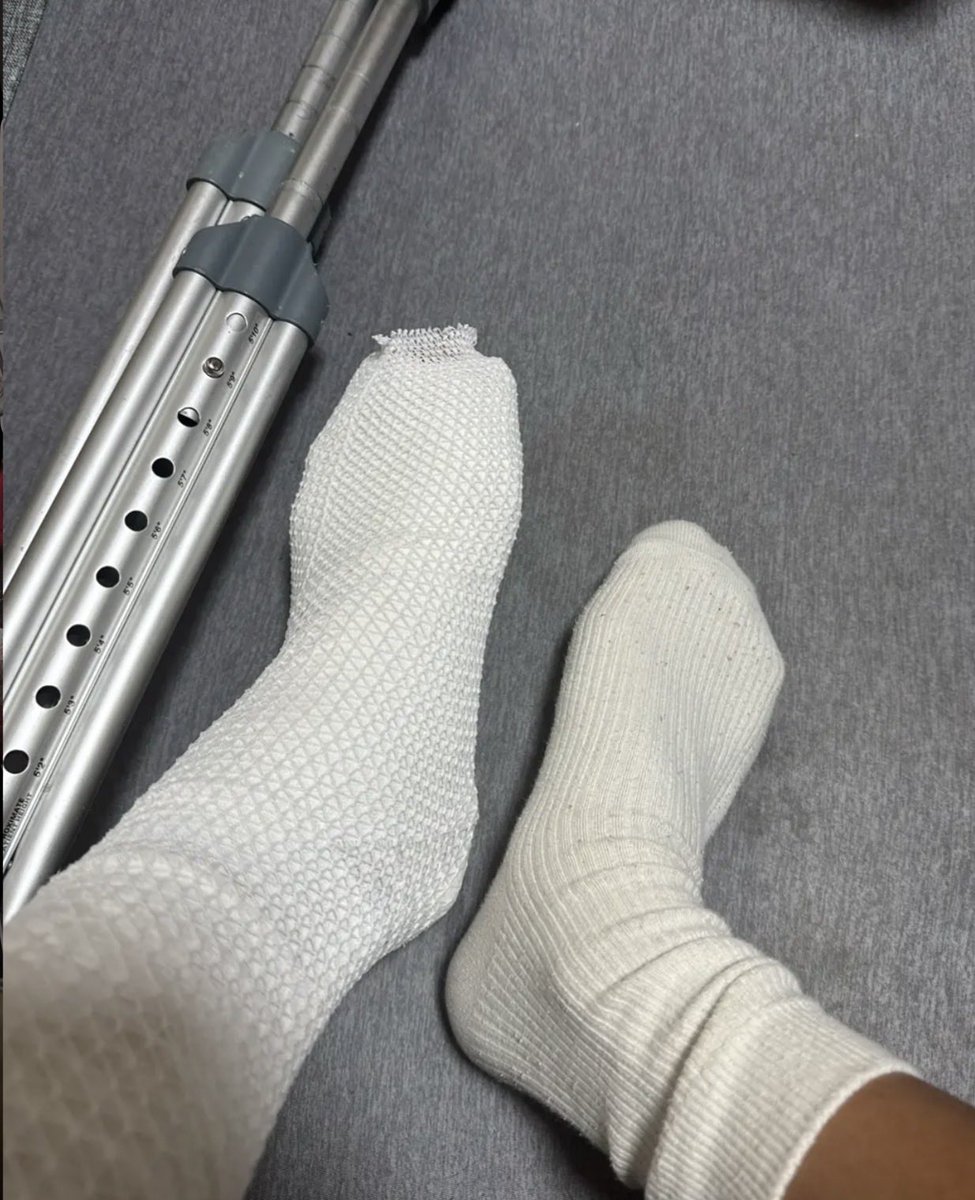 lzdh92's tweet photo. 靭帯断裂してた😢😢
みょんちゃんの曲聴いて頑張ります🎧

 @aimyonGtter 
 #あいみょん  #AIM
 #あいみょん好きと繋がりたい
 #AIMと繋がりたい https://t.co/nAsXibzxXY
