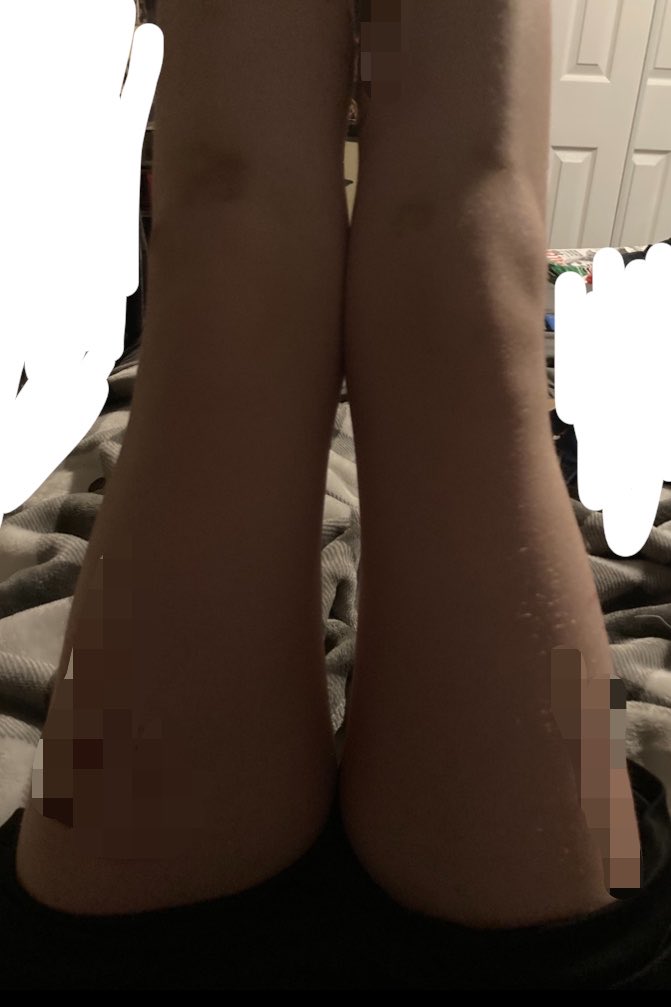 violentcaldream's tweet photo. july to now!! #edtwt #bodycheck #legcheck https://t.co/HFYqfwJLHa