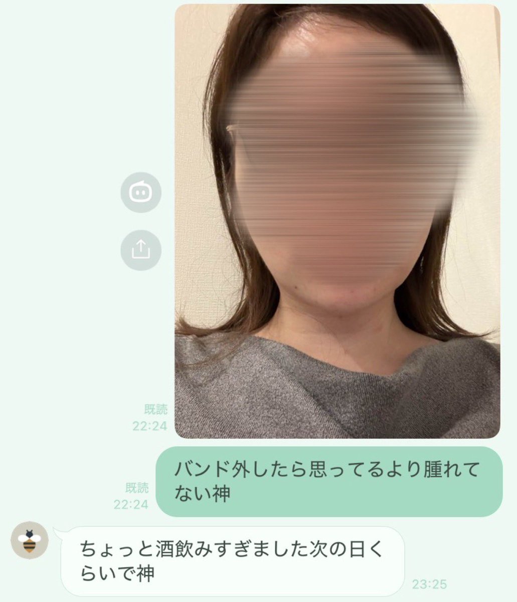 脂肪吸引2日目なんだけど腫れも痣も少なすぎて整形垢𝑭𝒓𝒊𝒆𝒏𝒅𝒔達に自慢しまくってるしみんな感動しててなんか私が誇らしい気持ちWWWWWWWWWWW https://t.co/OLi97vCIc0