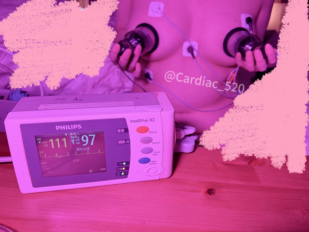 Cardiac_520's tweet photo. 9.30日训练反馈
1.睡觉不闭夹有尿床的感觉，会突然惊醒，然后想到自己插了尿管，又安心的睡过去。（目前膀胱容量为750ml)
2.这个负压按摩有点痛痛，不拿着会掉，不过乳头被这些按摩还是蛮舒服的
（视频已经发在群里了，如果其他人想看的话，拜托点赞转发，如果反响不错的会考虑发👿) https://t.co/9ia9Dz7s12