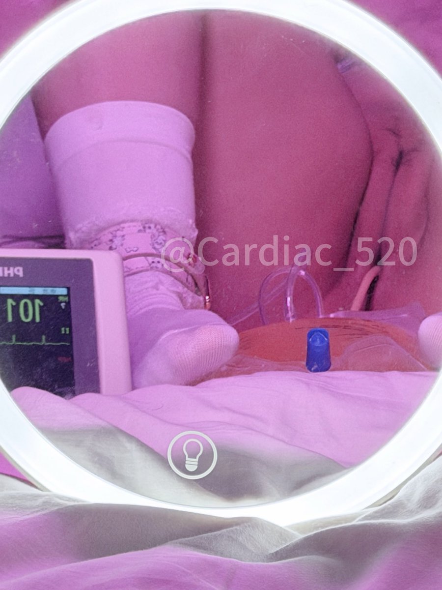 Cardiac_520's tweet photo. 9.30日训练反馈
1.睡觉不闭夹有尿床的感觉，会突然惊醒，然后想到自己插了尿管，又安心的睡过去。（目前膀胱容量为750ml)
2.这个负压按摩有点痛痛，不拿着会掉，不过乳头被这些按摩还是蛮舒服的
（视频已经发在群里了，如果其他人想看的话，拜托点赞转发，如果反响不错的会考虑发👿) https://t.co/9ia9Dz7s12