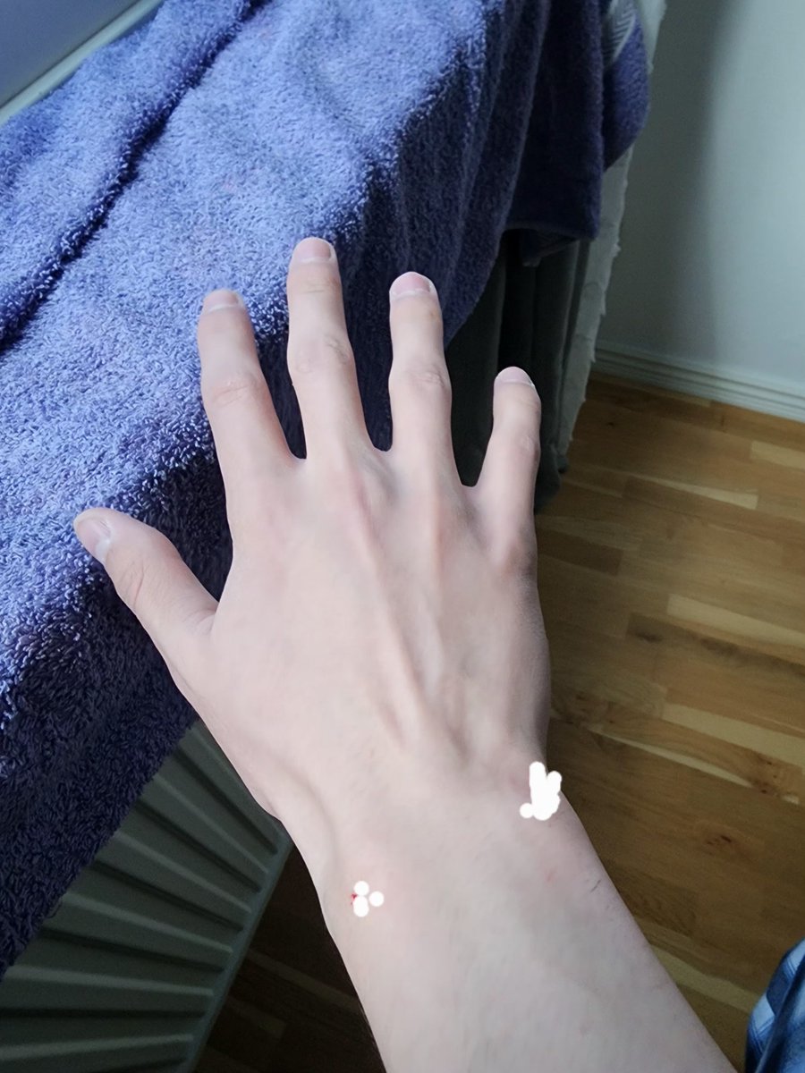 hopeeeee222's tweet photo. More pale how https://t.co/snSTiuZfju