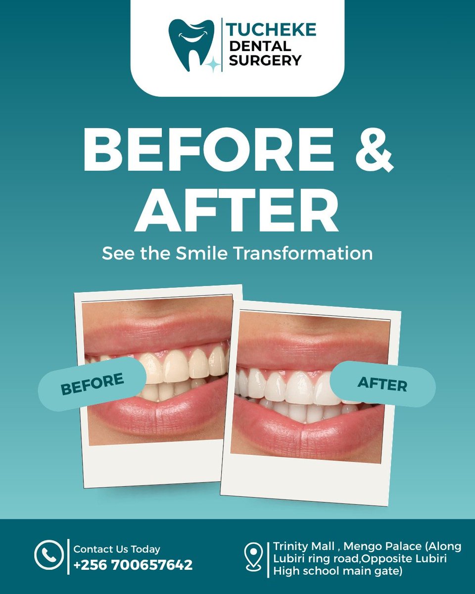 NyesigaRob2chek's tweet photo. @NewtonAllan6 I sell smiles that last https://t.co/PNC2mUPnfG