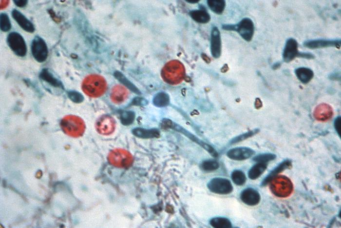 bactiman63's tweet photo. #Cryptosporidium outbreak linked to #Bothell, WA pool: Investigation #parasites #Seattle #Washington https://t.co/iMbNNh6zKk https://t.co/m433TpdBw7