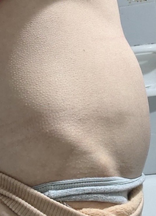 Fullbladder4's tweet photo. I didn’t let My gf pee this morning after we wake up. Now 3 Hours and 2 coffees later she have a bladderbulge and goosebumps from needing to pee so bad. But she is still Not allowed to pee. 😜 #peeholding #femaledesperation #bladderbulge #peedesperation https://t.co/K6PLJXBcEo
