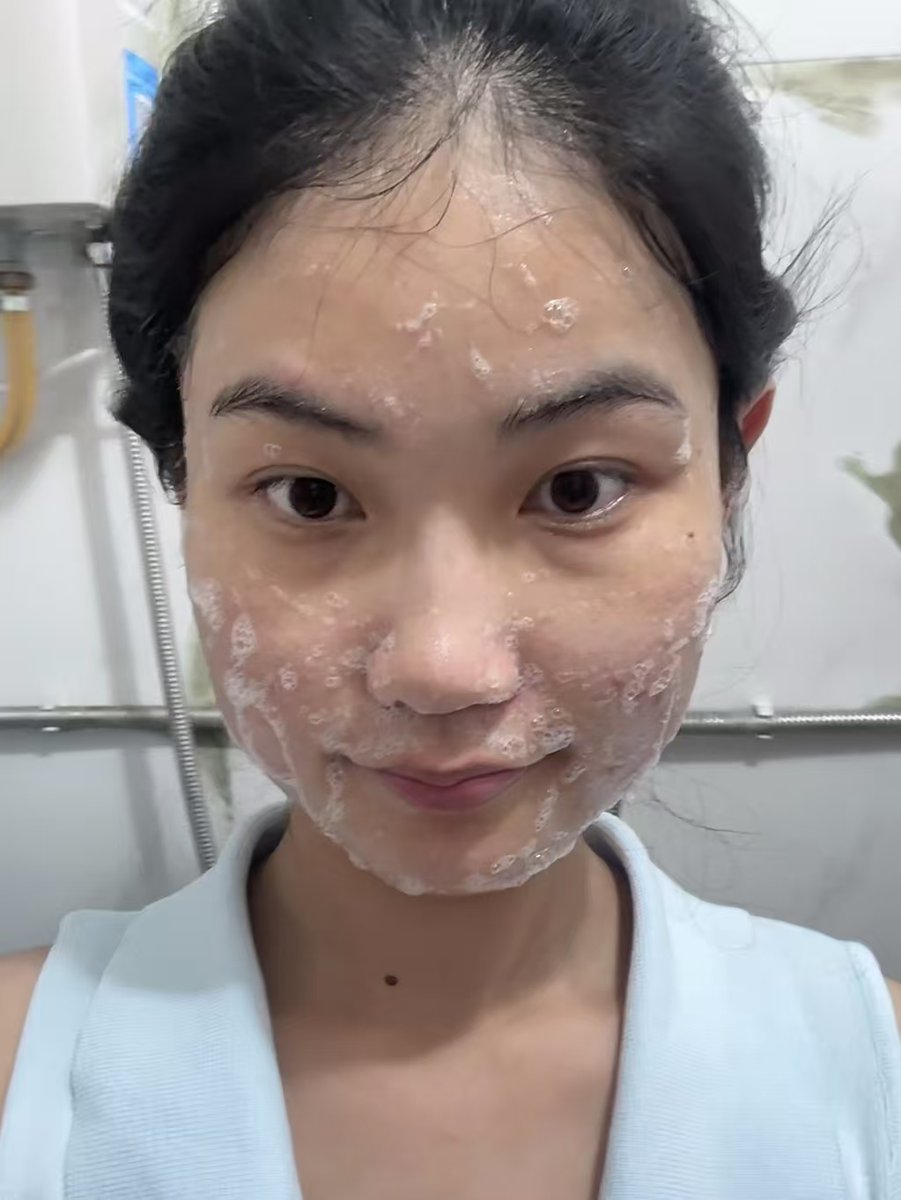 Kittithacho's tweet photo. [I caught a bad cold and had to stay in the痘窖. My friend came to visit me, but I didn't want to let her in because I was so 诽放端 embarrassed about my face covered in small pimples.] https://t.co/3A3YmFroWC