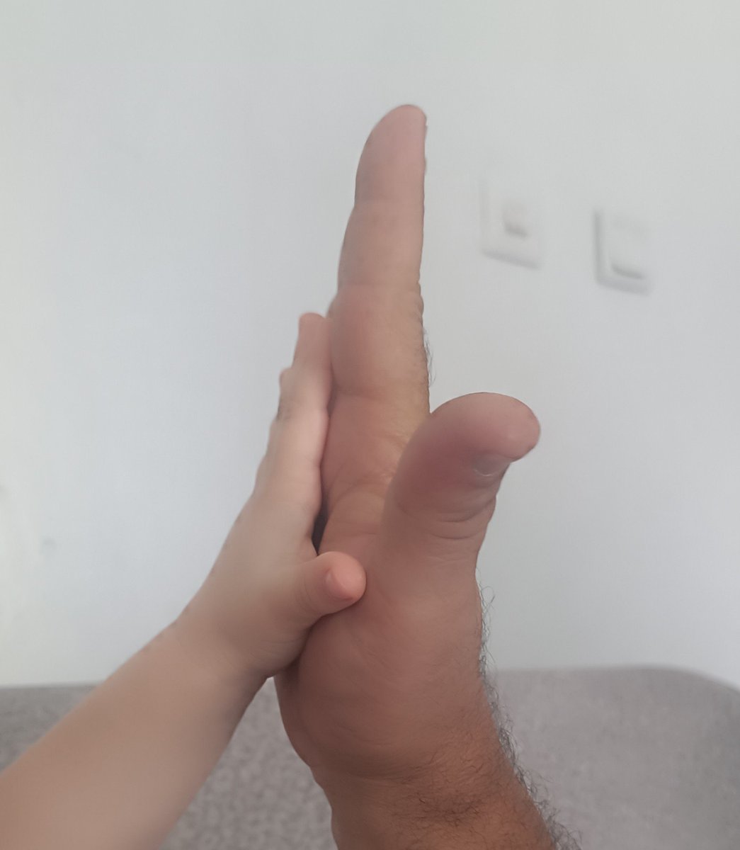 Mire_Xerzan's tweet photo. Disa dewran liser sere mê kurda Didom'e
Her çar perçe dive bi lez u bez bibin yek 
Wext wexta yekîtîya kurda yê.✌🏻✌🏻✌🏻✌🏻

Bila baş be zanîn ku kesekî Kurda tinne 
Jî Kurda pevê .... https://t.co/nv7vQPBGua
