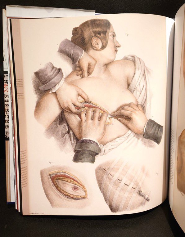 FactoryMother's tweet photo. 『Hidden Treasure: The National Library of Medicine』
175年の歴史を有するアメリカ国立医学図書館の品々を紹介します。人間の断面、両性具有者、皮膚病の図鑑、ヒトラーのX線写真など収録しています。
MOTHER FACTORYに常設されている「書肆ゲンシシャの本棚 in 川崎 溝の口」にてご覧頂けます。 https://t.co/qnB2R9q9v9