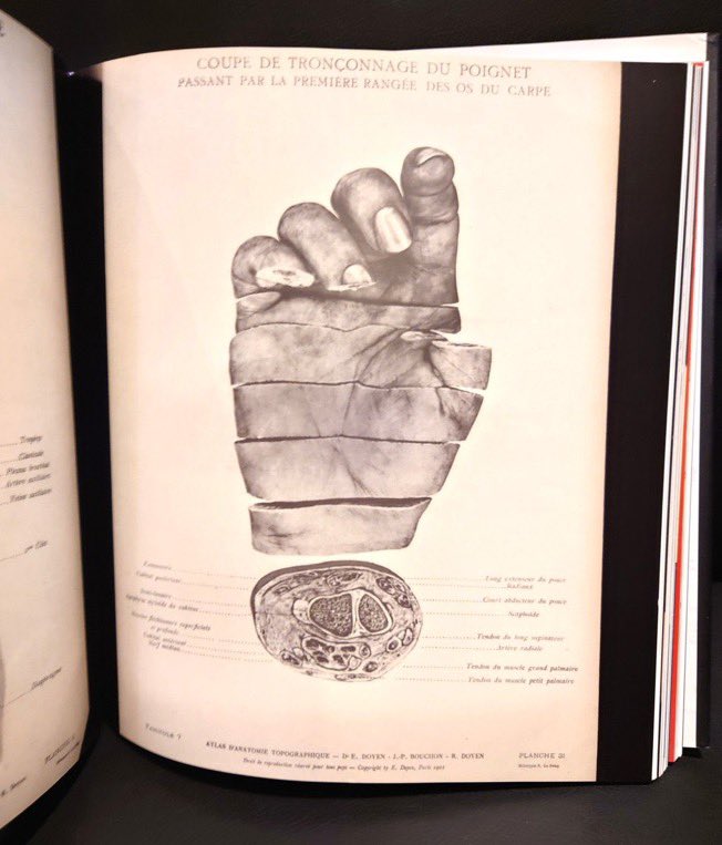 FactoryMother's tweet photo. 『Hidden Treasure: The National Library of Medicine』
175年の歴史を有するアメリカ国立医学図書館の品々を紹介します。人間の断面、両性具有者、皮膚病の図鑑、ヒトラーのX線写真など収録しています。
MOTHER FACTORYに常設されている「書肆ゲンシシャの本棚 in 川崎 溝の口」にてご覧頂けます。 https://t.co/qnB2R9q9v9