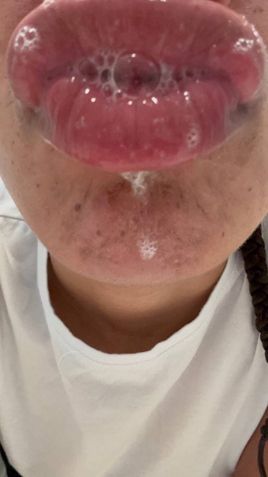 LIPSnBADDIES's tweet photo. freckled lightskin baddie with spitty DSLs 😵‍💫💦💋 (message my telegram @ CEOverse for groups or more)
-
#lips #lipgooner #DSL #biglips #lipfetish #nutty #gooner #gooning #faceporn #goonfuel #juicylips #freckles #spitfetish #pyt #fineshit #baddies #lipgloss #kisses #spit #ebonydsl https://t.co/HsquCcOvnM