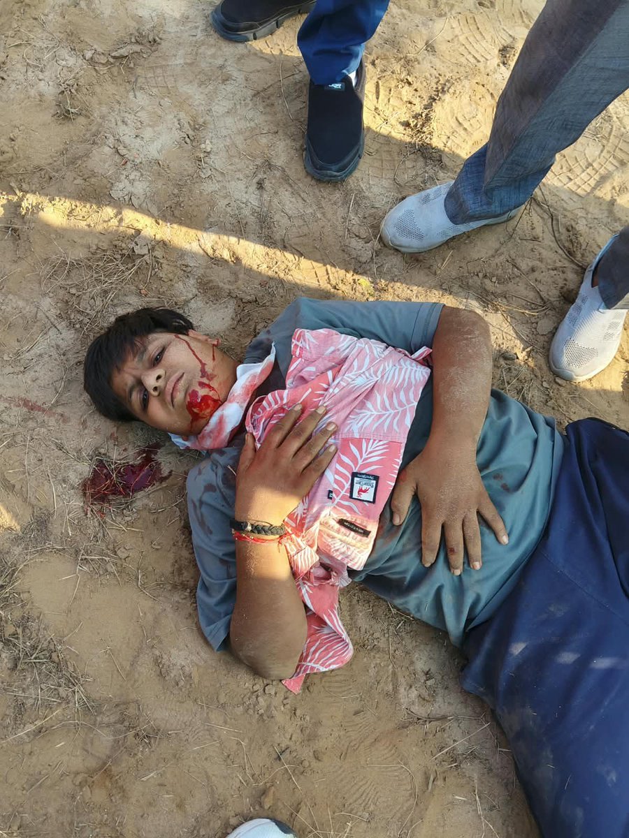 Press0080's tweet photo. बिजनौर के नूरपुर क्षेत्र में एक किशोर पर चाकू से हमले की गंभीर घटना सामने आई है स्थानीय पुलिस प्रशासन से विनम्र अनुरोध है कि इस मामले का संज्ञान लेते हुए निष्पक्ष जांच की जाए और दोषियों के खिलाफ नियमानुसार सख्त कार्रवाई की जाए 
@Uppolice @bijnorpolice https://t.co/F4u6wjeTLd