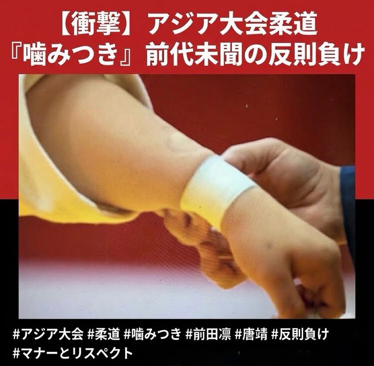 Izumi_Sunagawa's tweet photo. アジア大会柔道の女子70キロ級準々決勝。

寝技の攻防中に中国の唐靖が日本の前田凛選手の左腕に噛みついたとして反則負け。

前田選手の腕にはガッツリと歯型が残ってる。

中国人には武道の精神やスポーツマンシップがないのか。

もう国際大会に出てくるなよ。 https://t.co/Uuka1XGPb1