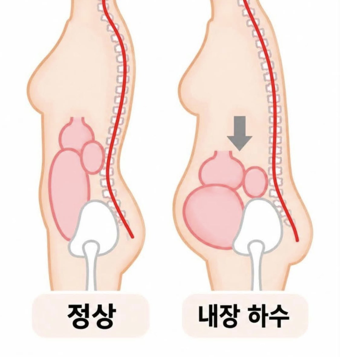 piayoonej's tweet photo. 자기 전에 이것만 해!
벽에 다리 올리고 10~15분하면서 엑스하기 ◡̈ 

뱃살인 줄 알았는데
내장하수 때문일 수도 있다고 함.

다리를 심장보다 높게 올려주면
하체 순환에도 도움 되고
하루 종일 쌓인 붓기와 피로를 풀어주는 데 좋음.

돈 0원짜리 하체 순환 관리.
오늘부터다!! https://t.co/ycp8V9t8yO