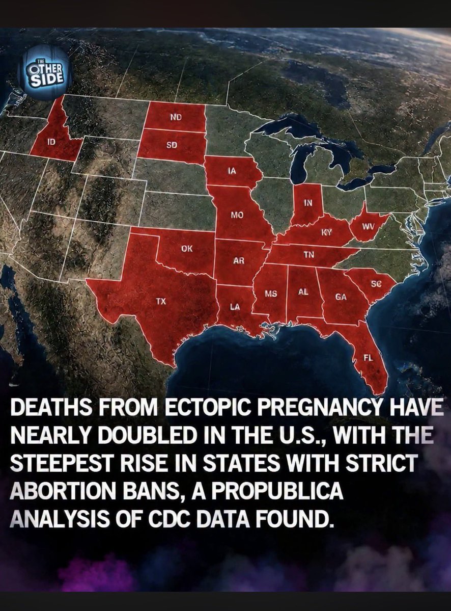 AbortionChat's tweet photo. It’s almost like abortion bans kill people.

Like we’ve been saying all along. https://t.co/mqhk5Lcjx5